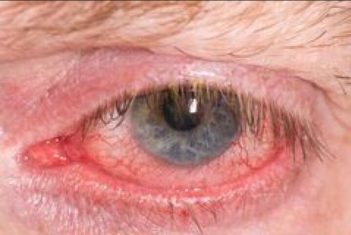 SmartSelect_20210630-163423_DuckDuckGo